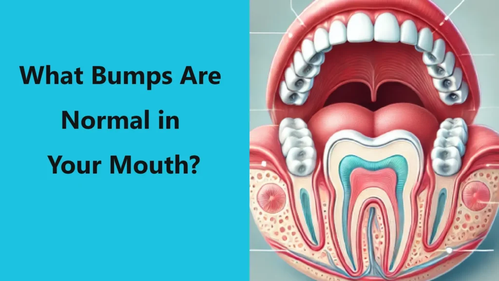 Normal-Mouth-Bumps