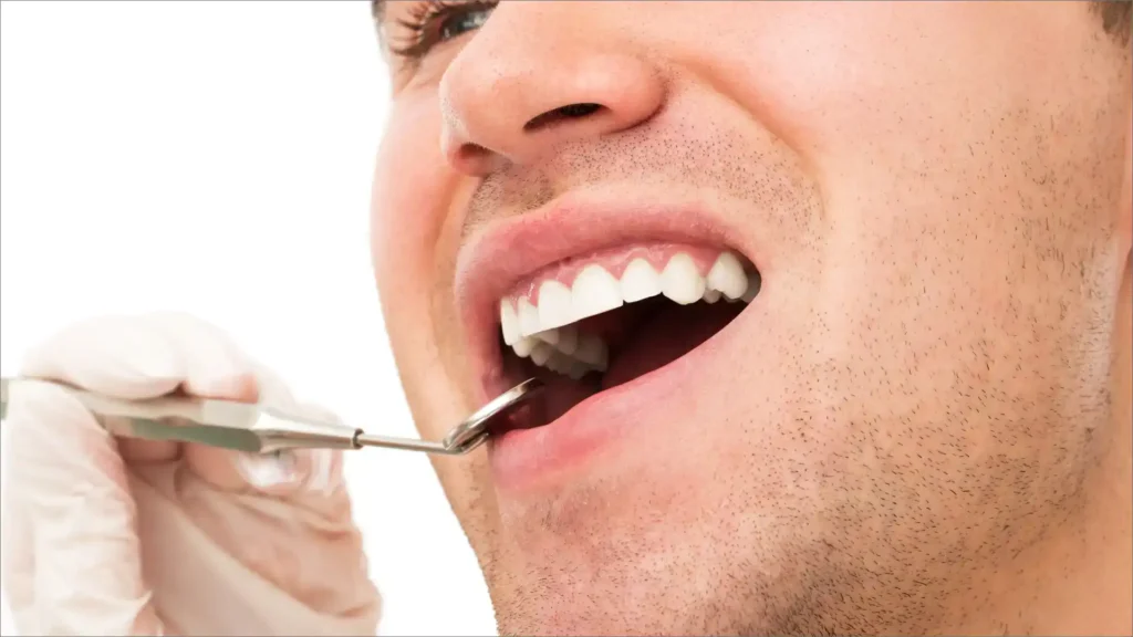 What-Does a-Cavity-Look-Like-FIMage