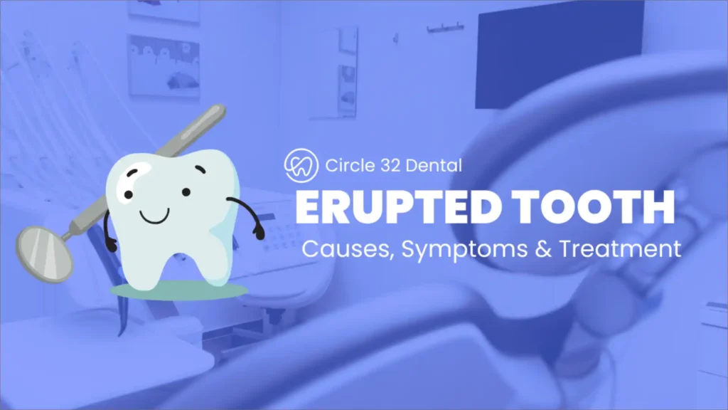 Learn what erupted tooth is?